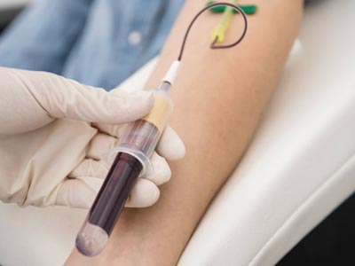 Blutentnahme bei Eigenblutbehandlung